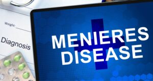 Understanding Meniere’s Disease